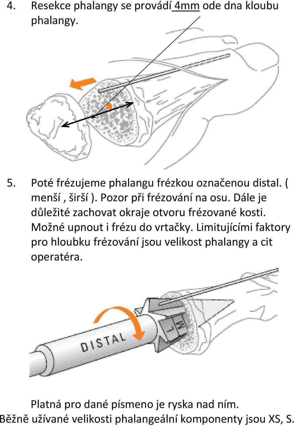 Dále je důležité zachovat okraje otvoru frézované kosti. Možné upnout i frézu do vrtačky.