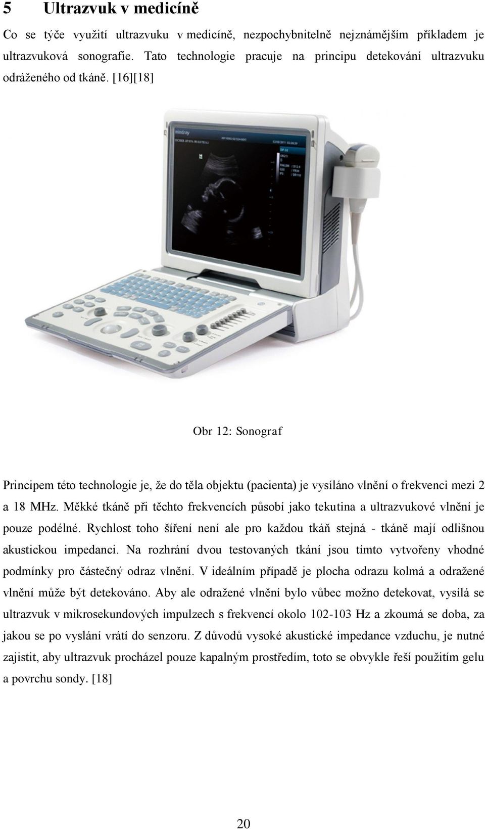 [16][18] Obr 12: Sonograf Principem této technologie je, že do těla objektu (pacienta) je vysíláno vlnění o frekvenci mezi 2 a 18 MHz.