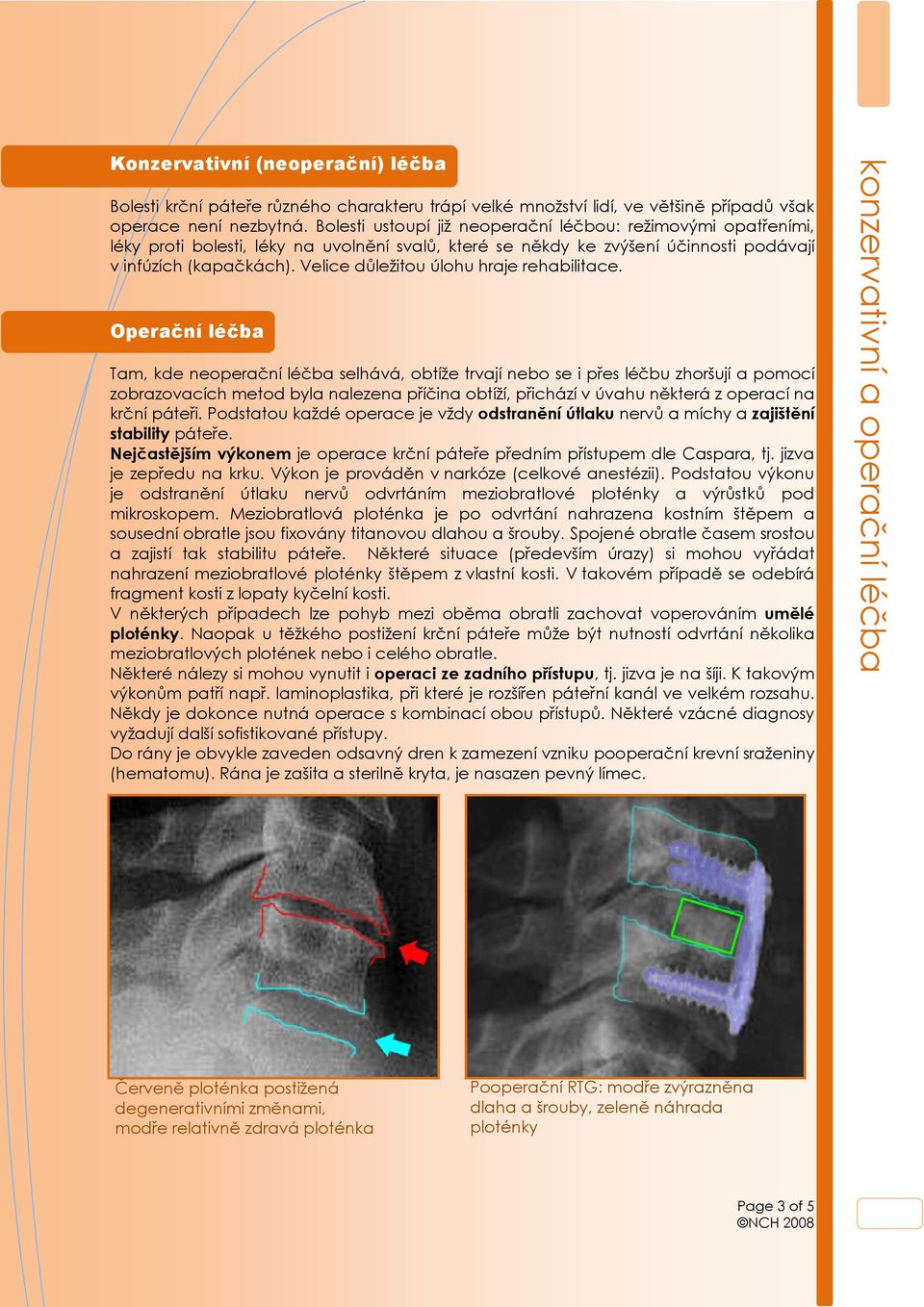 Velice důležitou úlohu hraje rehabilitace.