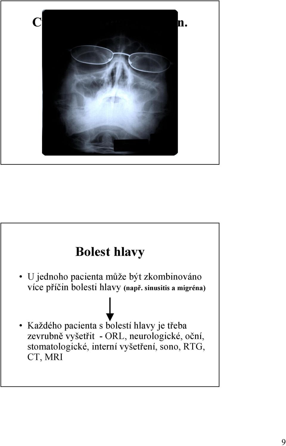 bolesti hlavy (např.