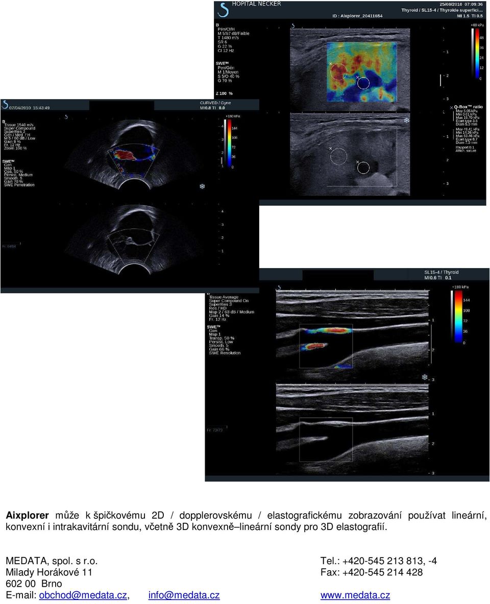 pro 3D elastografií. MEDATA, spol. s r.o. Tel.