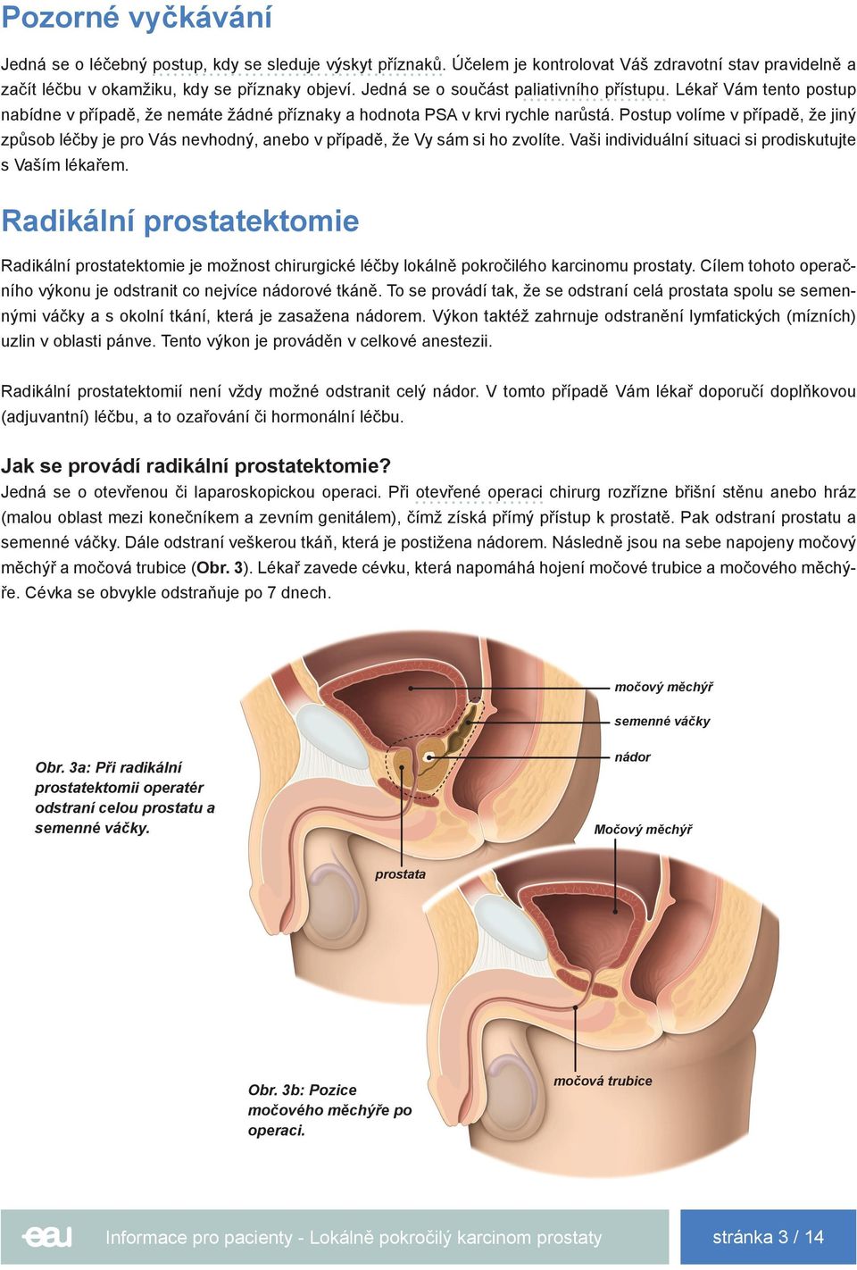 Postup volíme v případě, že jiný způsob léčby je pro Vás nevhodný, anebo v případě, že Vy sám si ho zvolíte. Vaši individuální situaci si prodiskutujte s Vaším lékařem.