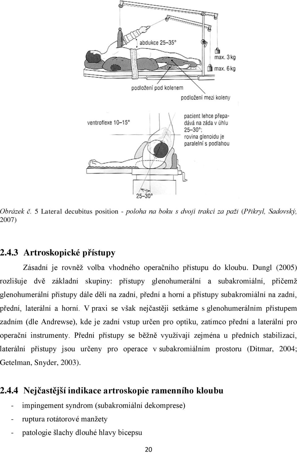 laterální a horní. V praxi se však nejčastěji setkáme s glenohumerálním přístupem zadním (dle Andrewse), kde je zadní vstup určen pro optiku, zatímco přední a laterální pro operační instrumenty.