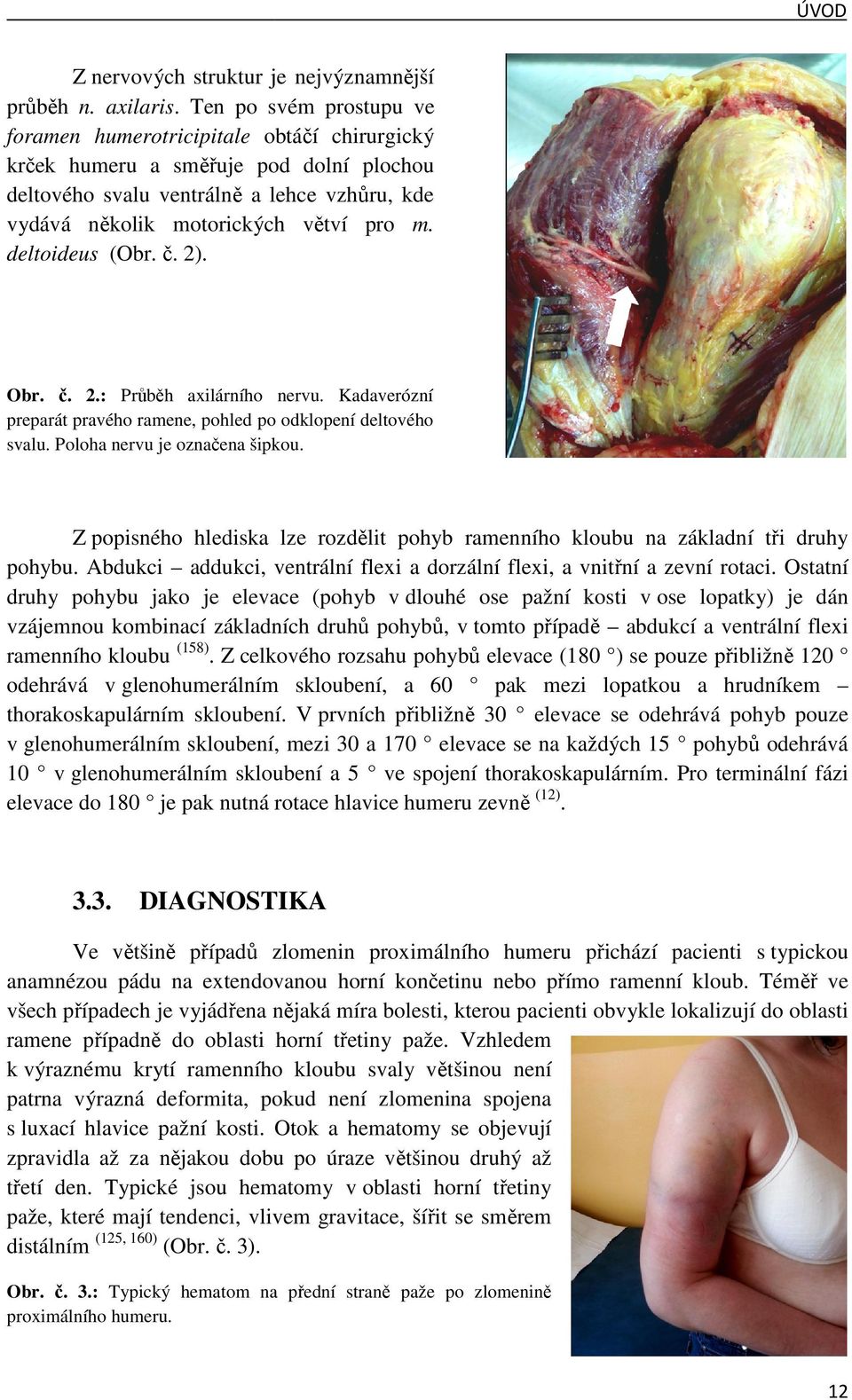 motorických větví v pro m. deltoideus (Obr. č. 2). Obr. č. 2.: Průběhh axilárního nervu. Kadaverózní preparát pravého ramene, pohled po odklopení deltového svalu. Poloha nervu je označena ena šipkou.