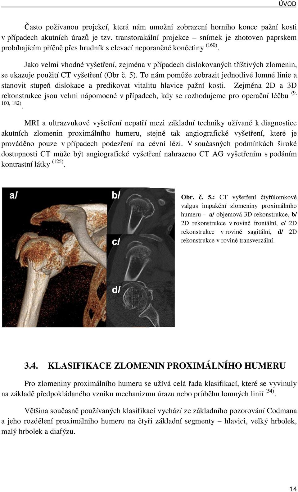 Jako velmi vhodné vyšetření, zejména v případech dislokovaných tříštivých zlomenin, se ukazuje použití CT vyšetření (Obr č. 5).