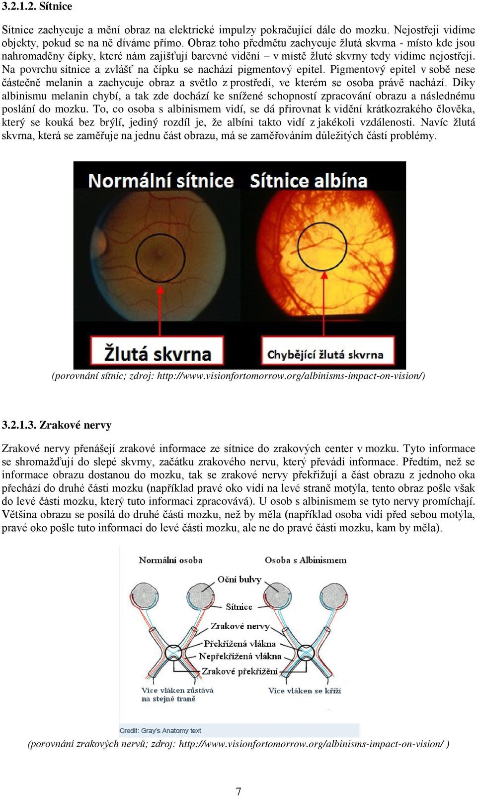 Na povrchu sítnice a zvlášť na čípku se nachází pigmentový epitel. Pigmentový epitel v sobě nese částečně melanin a zachycuje obraz a světlo z prostředí, ve kterém se osoba právě nachází.