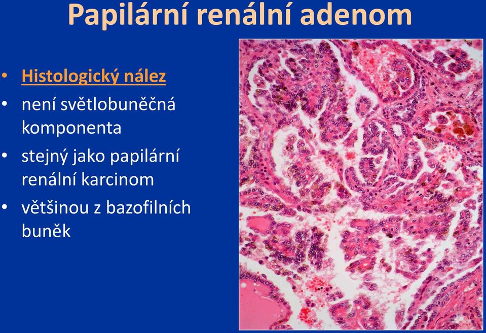 světlobuněčná komponenta stejný