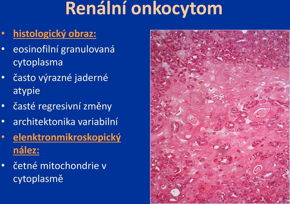 regresivní změny architektonika variabilní