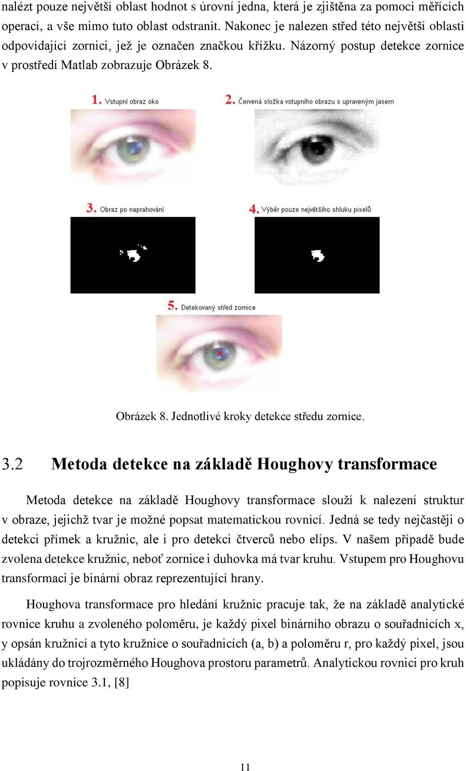 Obrázek 8. Jednotlivé kroky detekce středu zornice.