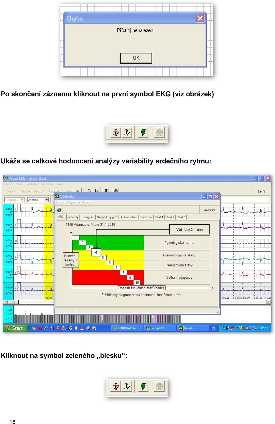 hodnocení analýzy variability srdečního