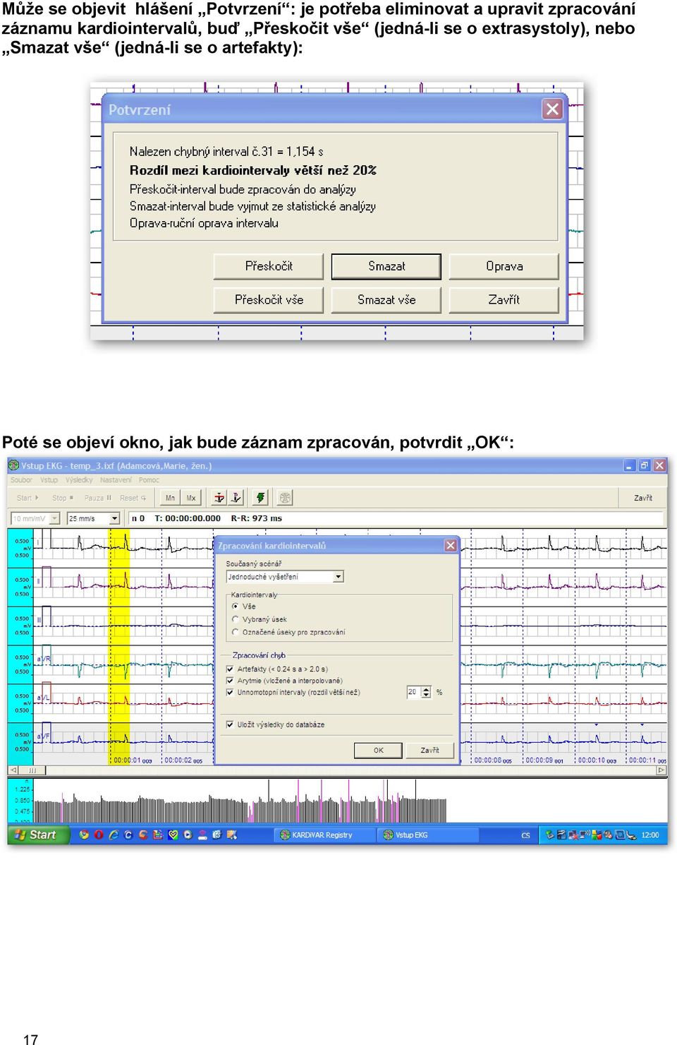 (jedná-li se o extrasystoly), nebo Smazat vše (jedná-li se o