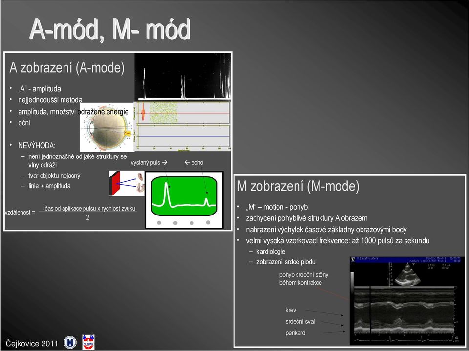 x rychlost zvuku 2 M motion - pohyb zachycení pohyblivé struktury A obrazem nahrazení výchylek časové základny obrazovými body velmi vysoká