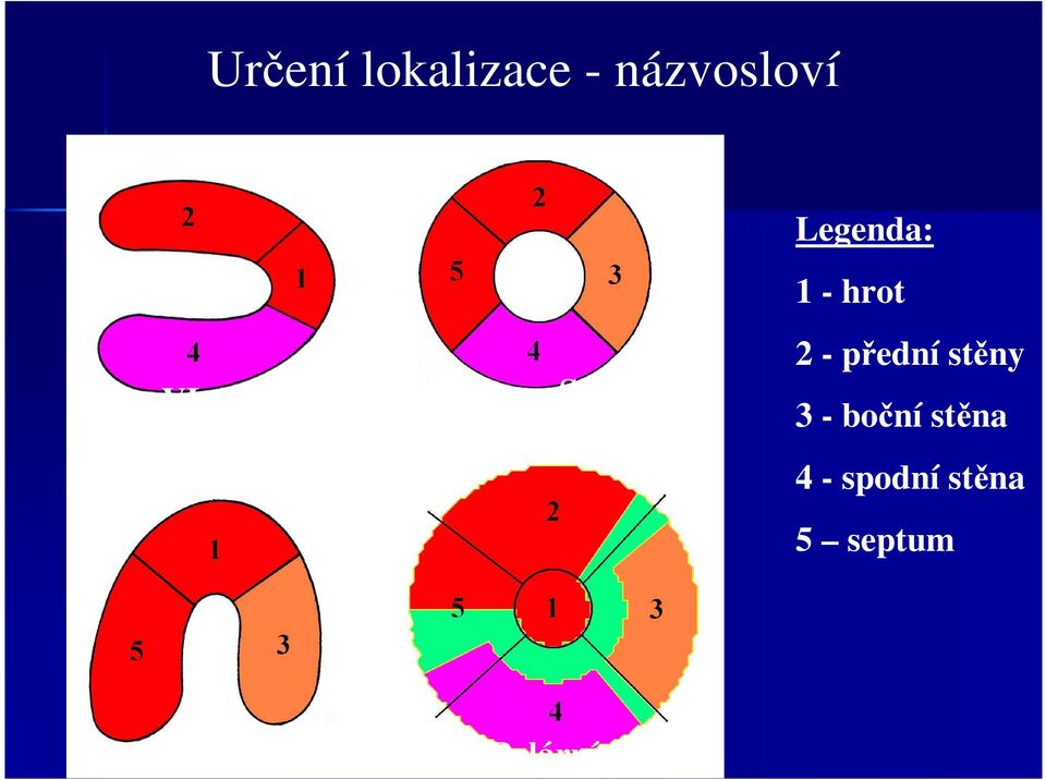 přední stěny 3 - boční stěna 4 -