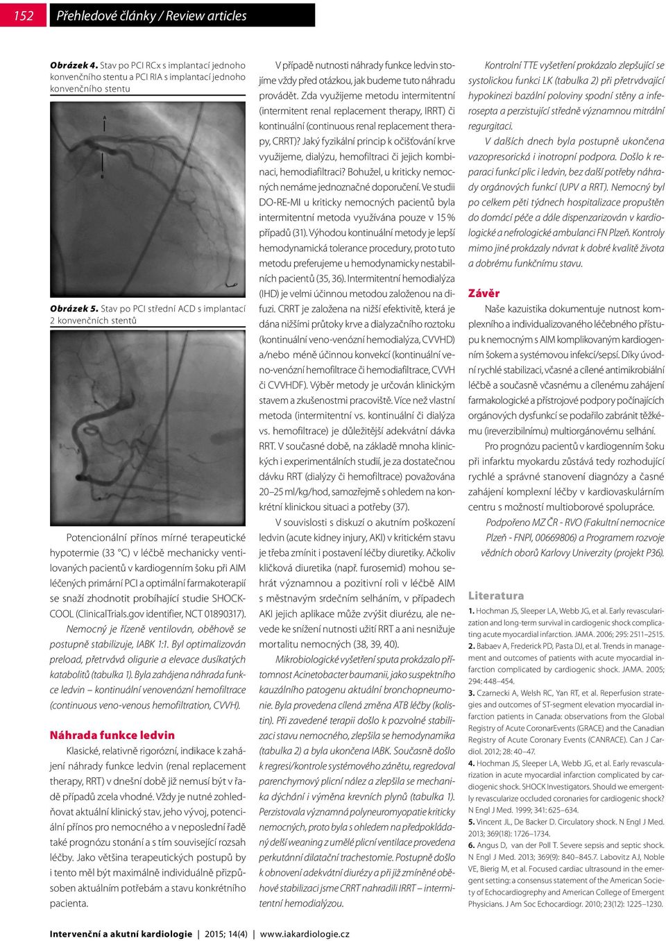 primární PCI a optimální farmakoterapií se snaží zhodnotit probíhající studie SHOCK- COOL (ClinicalTrials.gov identifier, NCT 01890317).