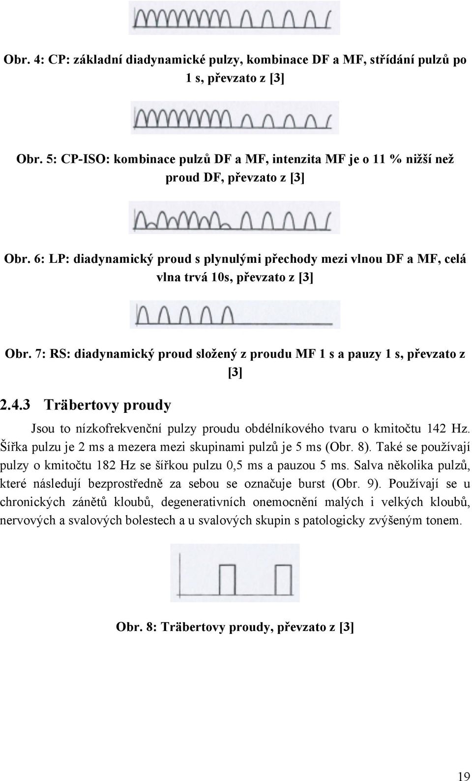 6: LP: diadynamický proud s plynulými přechody mezi vlnou DF a MF, celá vlna trvá 10s, převzato z [3] Obr. 7: RS: diadynamický proud složený z proudu MF 1 s a pauzy 1 s, převzato z [3] 2.4.