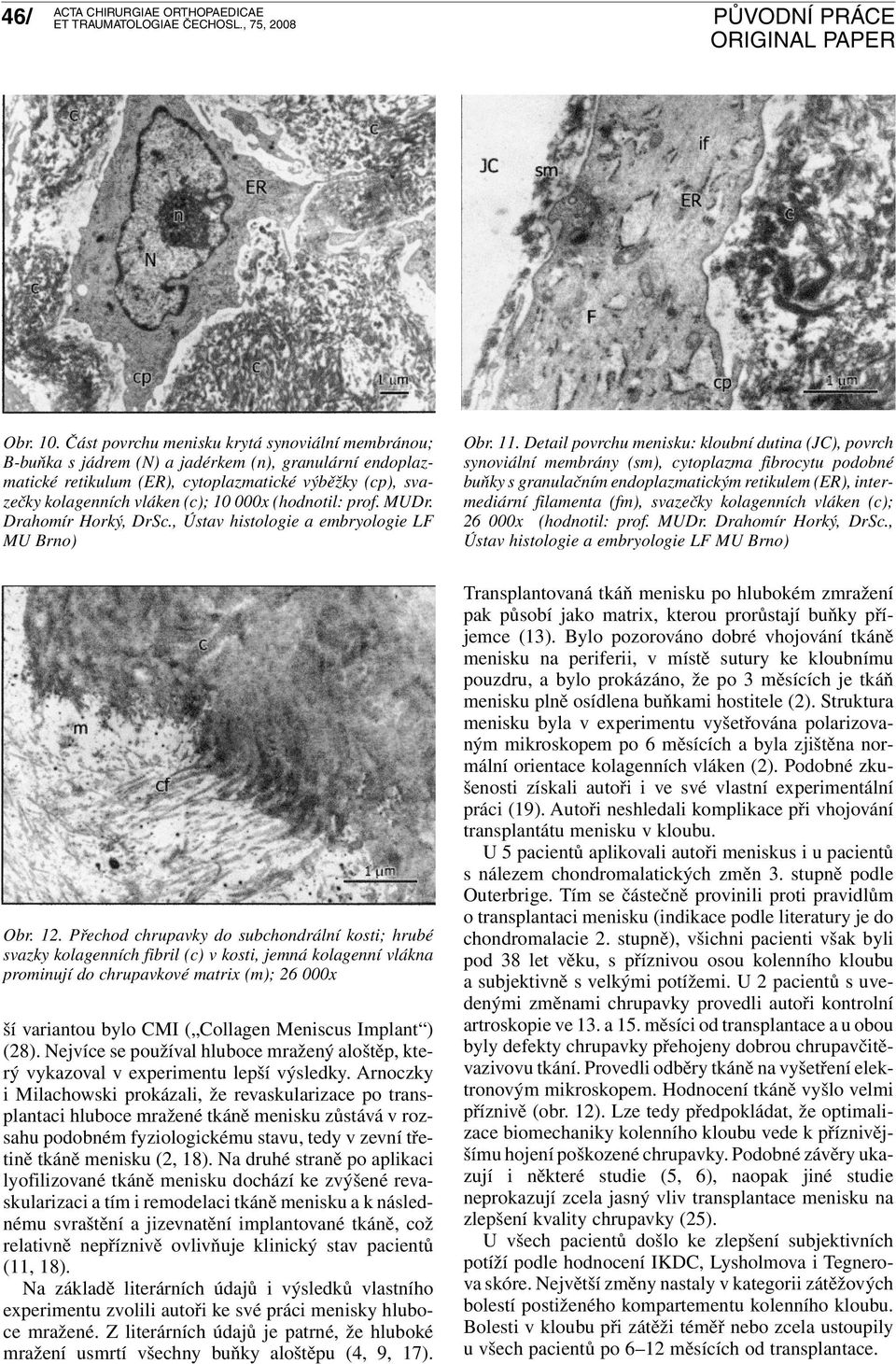 (hodnotil: prof. MUDr. Drahomír Horký, DrSc., Ústav histologie a embryologie LF MU Brno) Obr. 11.