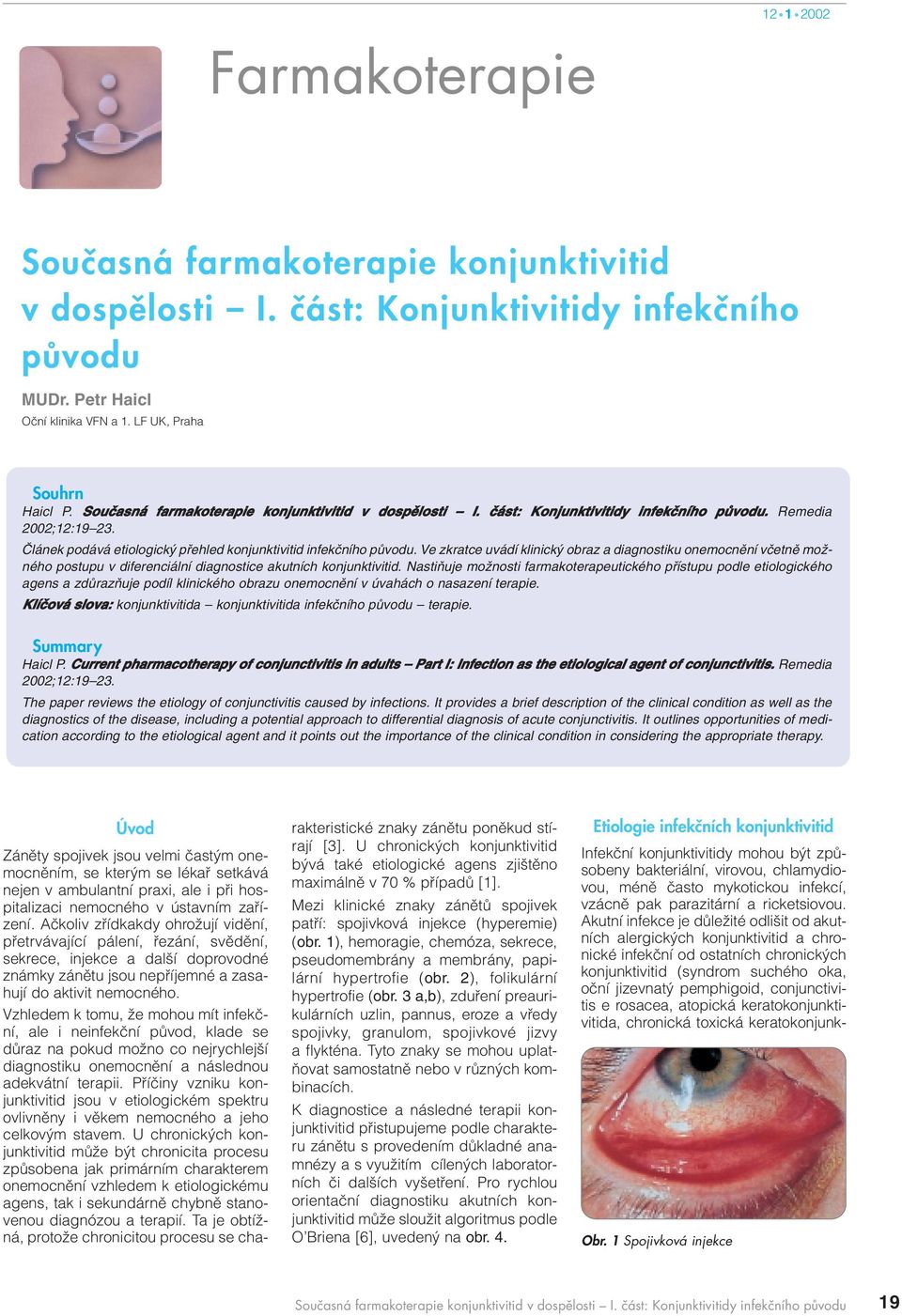 Ve zkratce uvádí klinick obraz a diagnostiku onemocnûní vãetnû moïného postupu v diferenciální diagnostice akutních konjunktivitid.