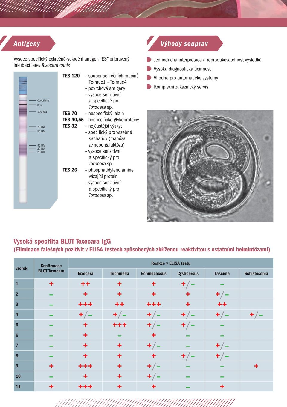 TES 70 nespecifický lektin TES 40,55 nespecifické glykoproteiny TES 32 nejčastější výskyt specifický pro vazebné sacharidy (manóza a/nebo galaktóza) vysoce senzitivní a specifický pro Toxocara sp.