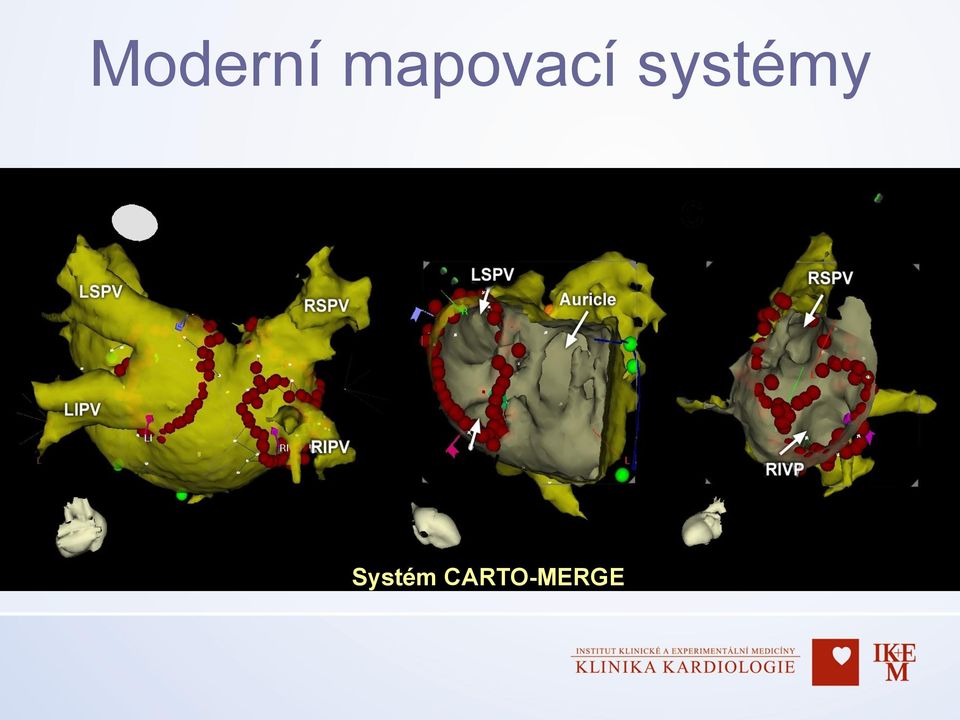 systémy