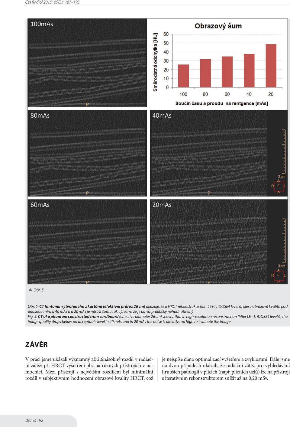 CT fantomu vytvořeného z kartónu (efektivní průřez 26 cm) ukazuje, že u HRCT rekonstrukce (filtr LE+1, idose4 level 6) klesá obrazová kvalita pod únosnou míru u 40 mas a u 20 mas je nárůst šumu tak