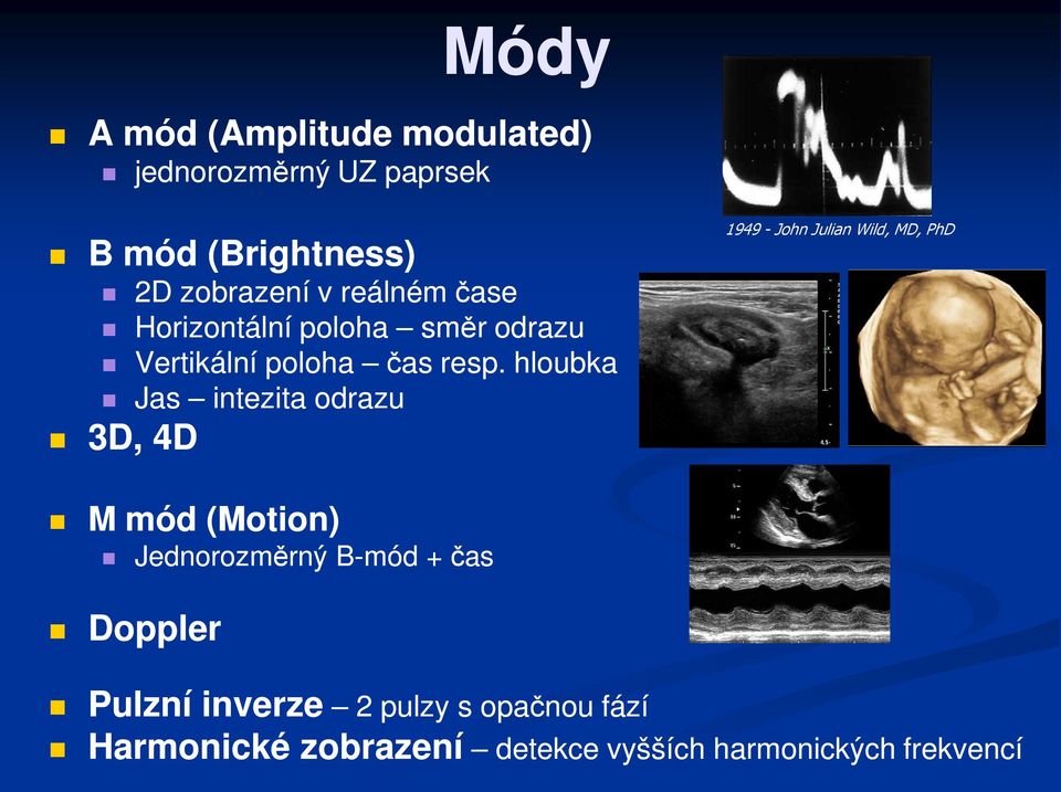 hloubka Jas intezita odrazu 3D, 4D 1949 - John Julian Wild, MD, PhD M mód (Motion) Jednorozměrný B-mód +