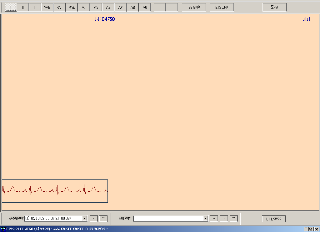 Obr.8. Okno modulu vyšetření mód Stránka Přecházení mezi dvěma módy zobrazení se děje pomocí tlačítka označeného F8 nebo pomocí dvojitého kliknutí na zápis EKG.