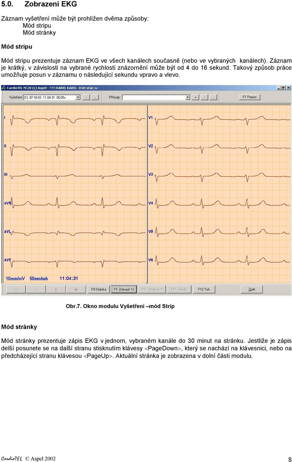 Obr.7. Okno modulu Vyšetření mód Strip Mód stránky Mód stránky prezentuje zápis EKG v jednom, vybraném kanále do 30 minut na stránku.