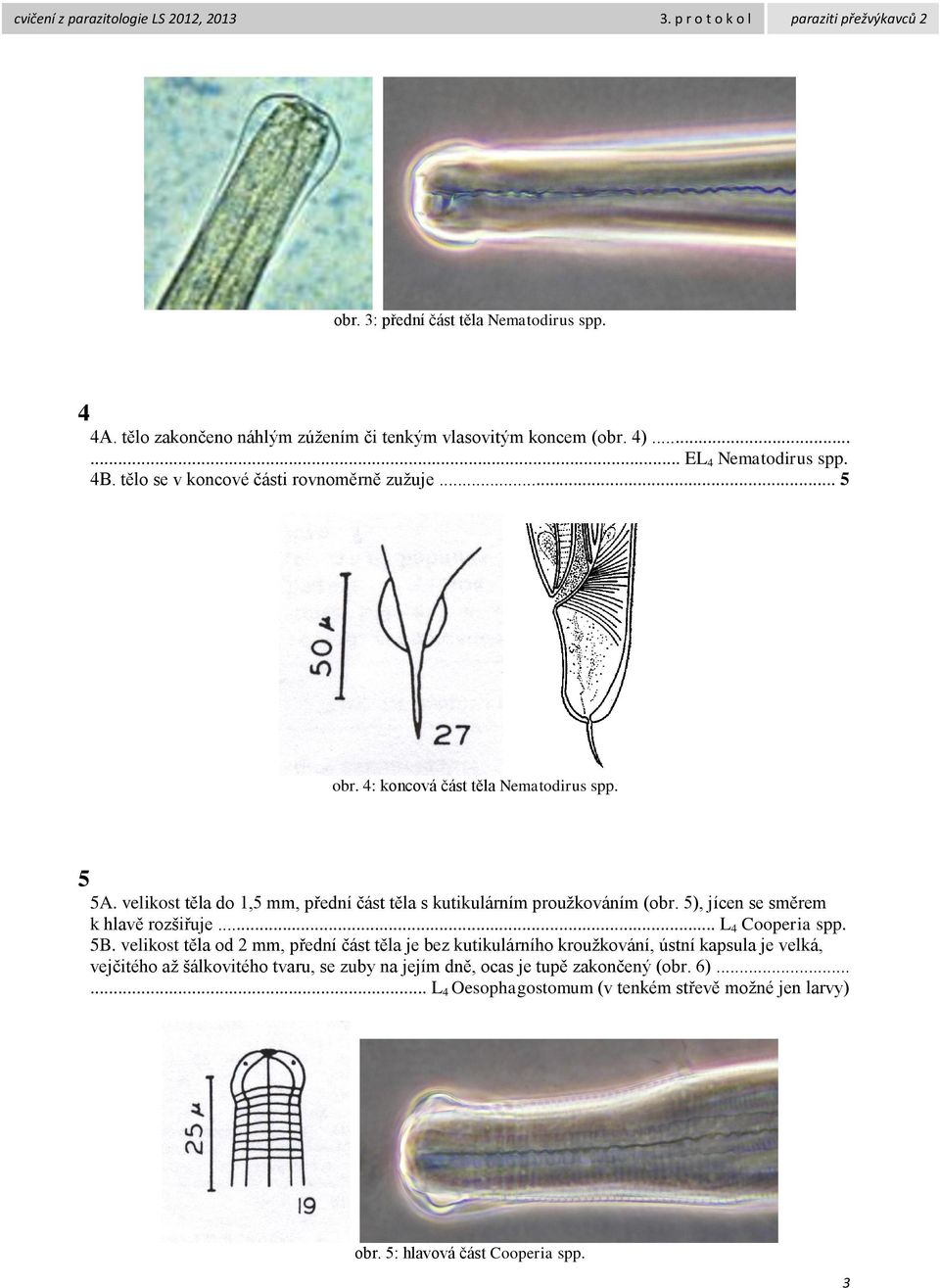 velikost těla do 1,5 mm, přední část těla s kutikulárním proužkováním (obr. 5), jícen se směrem k hlavě rozšiřuje... L 4 Cooperia spp. 5B.