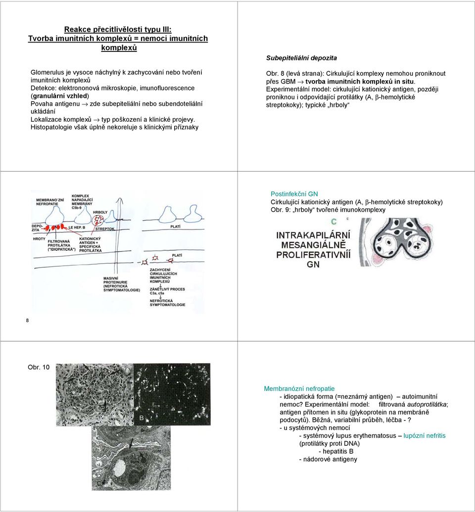 Histopatologie však úplně nekoreluje s klinickými příznaky Subepiteliální depozita Obr. 8 (levá strana): Cirkulující komplexy nemohou proniknout přes GBM tvorba imunitních komplexů in situ.