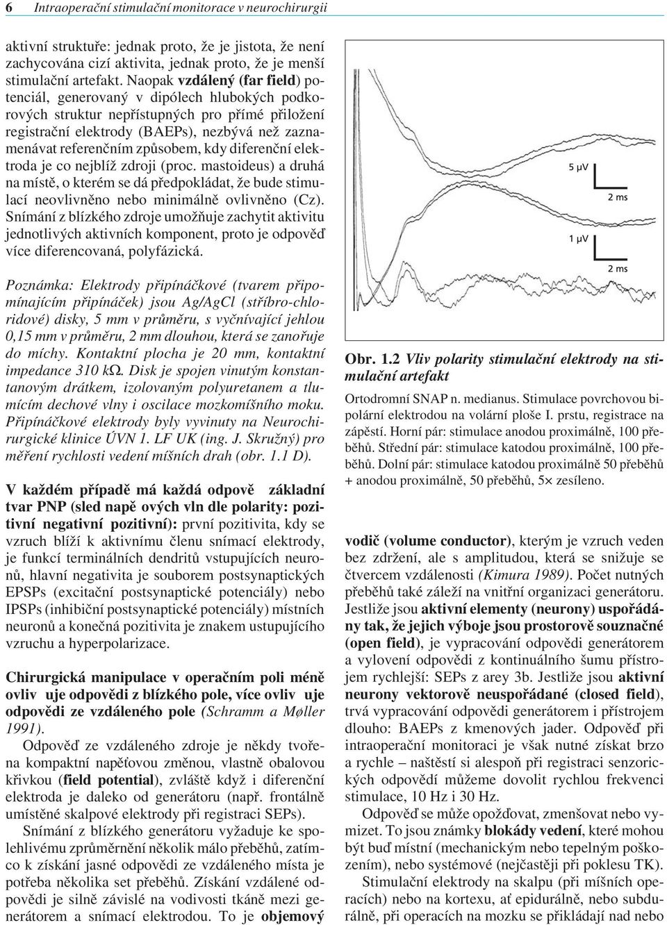 způsobem, kdy diferenční elektroda je co nejblíž zdroji (proc. mastoideus) a druhá na místě, o kterém se dá předpokládat, že bude stimulací neovlivněno nebo minimálně ovlivněno (Cz).