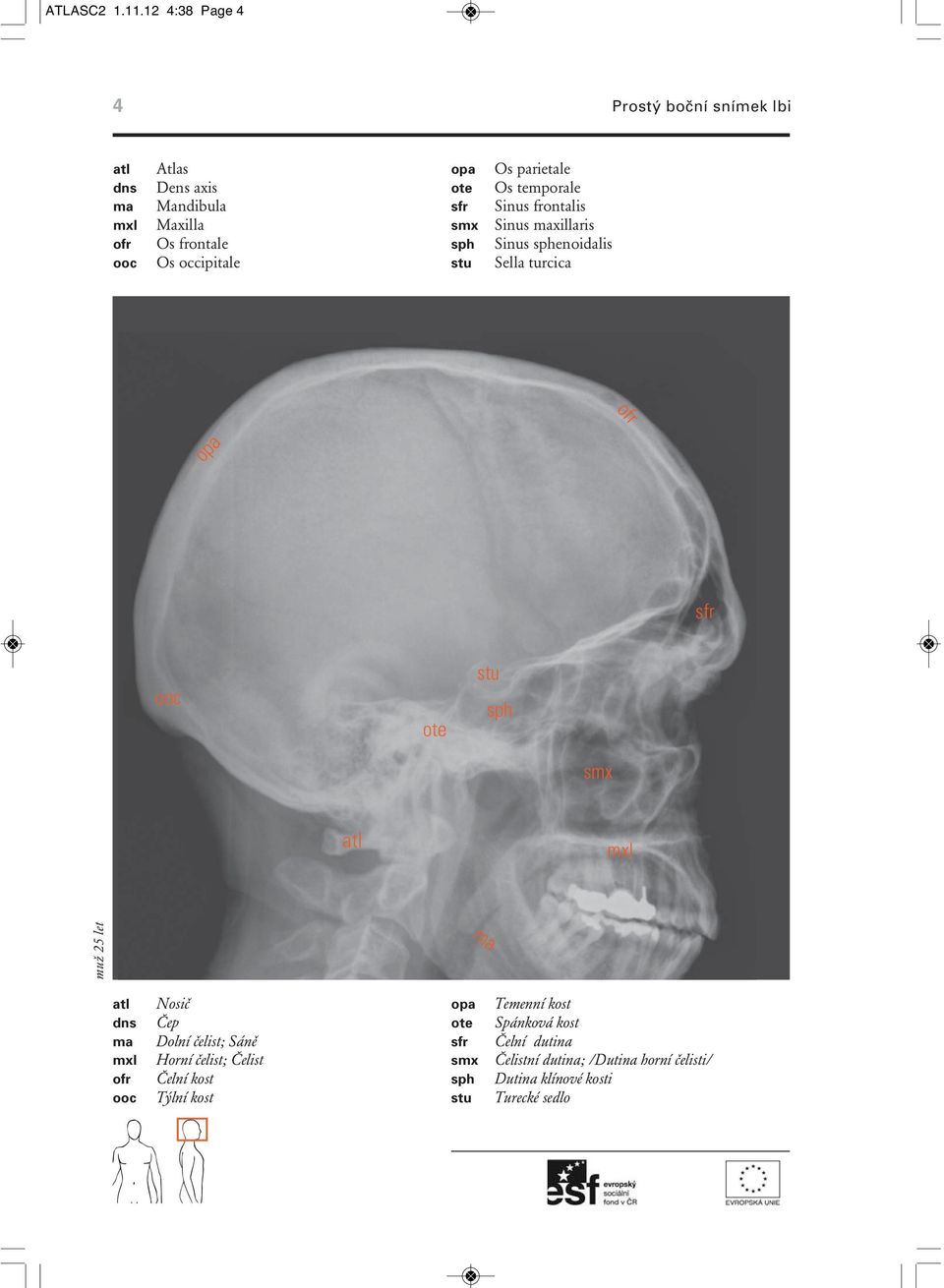 ote sfr smx sph stu Os parietale Os temporale Sinus frontalis Sinus maxillaris Sinus sphenoidalis Sella turcica ofr sfr ooc ote stu