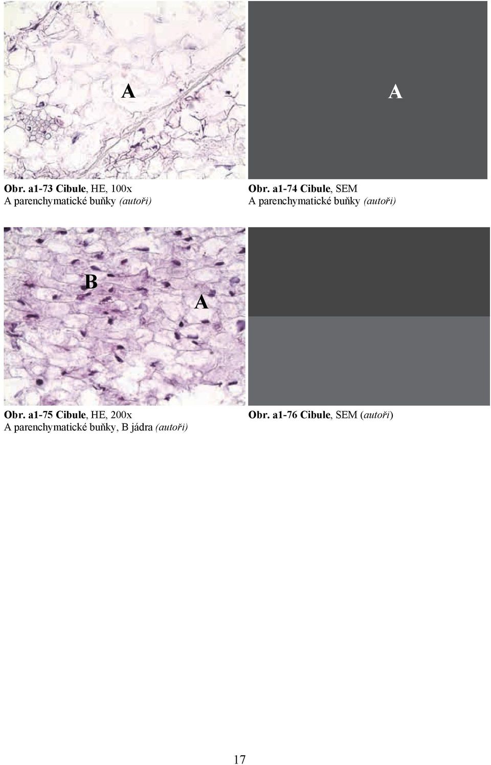 a1-74 ibule, SEM parenchymatické  a1-75