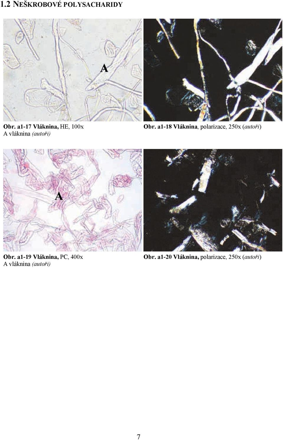 a1-18 Vláknina, polarizace, 250x Obr.