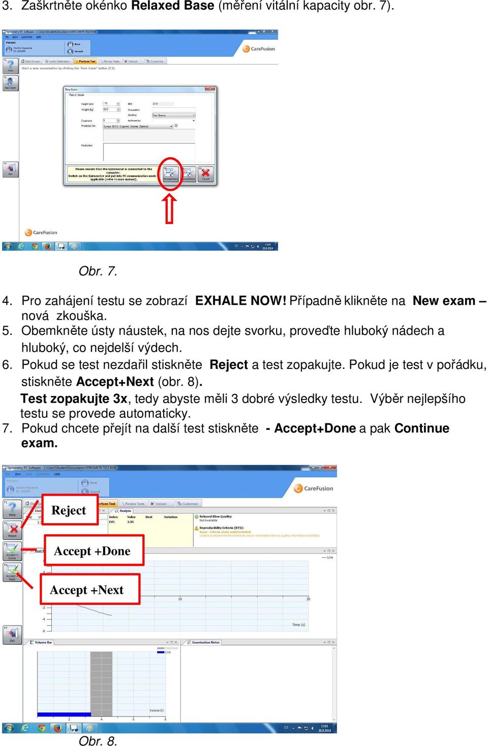 Pokud se test nezdařil stiskněte Reject a test zopakujte. Pokud je test v pořádku, stiskněte Accept+Next (obr. 8).