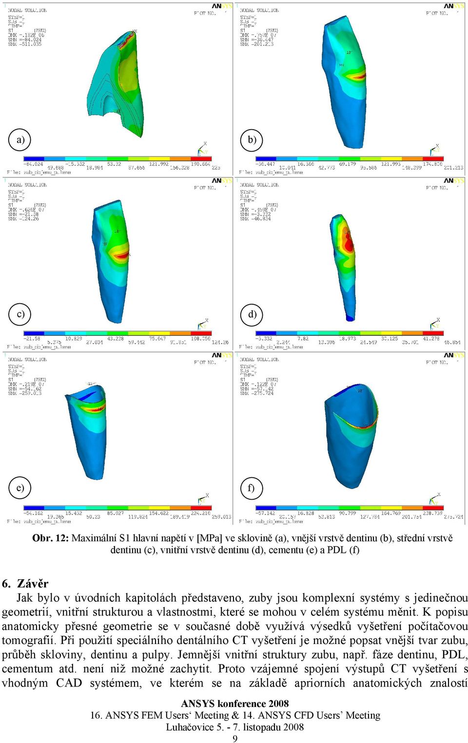 K popisu anatomicky přesné geometrie se v současné době využívá výsedků vyšetření počítačovou tomografií.