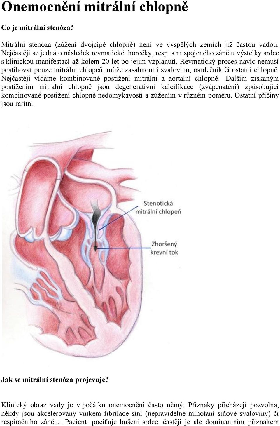Revmatický proces navíc nemusí postihovat pouze mitrální chlopeň, může zasáhnout i svalovinu, osrdečník či ostatní chlopně. Nejčastěji vídáme kombinované postižení mitrální a aortální chlopně.