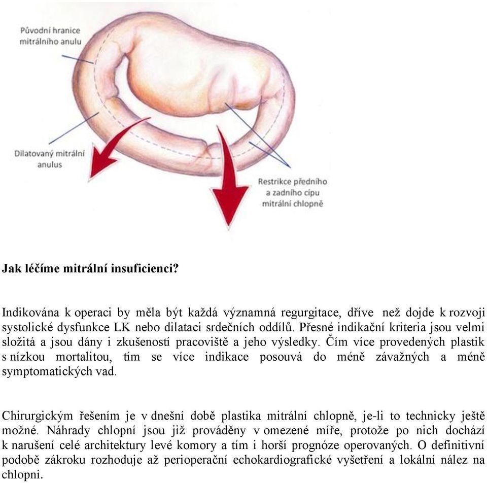 Čím více provedených plastik s nízkou mortalitou, tím se více indikace posouvá do méně závažných a méně symptomatických vad.