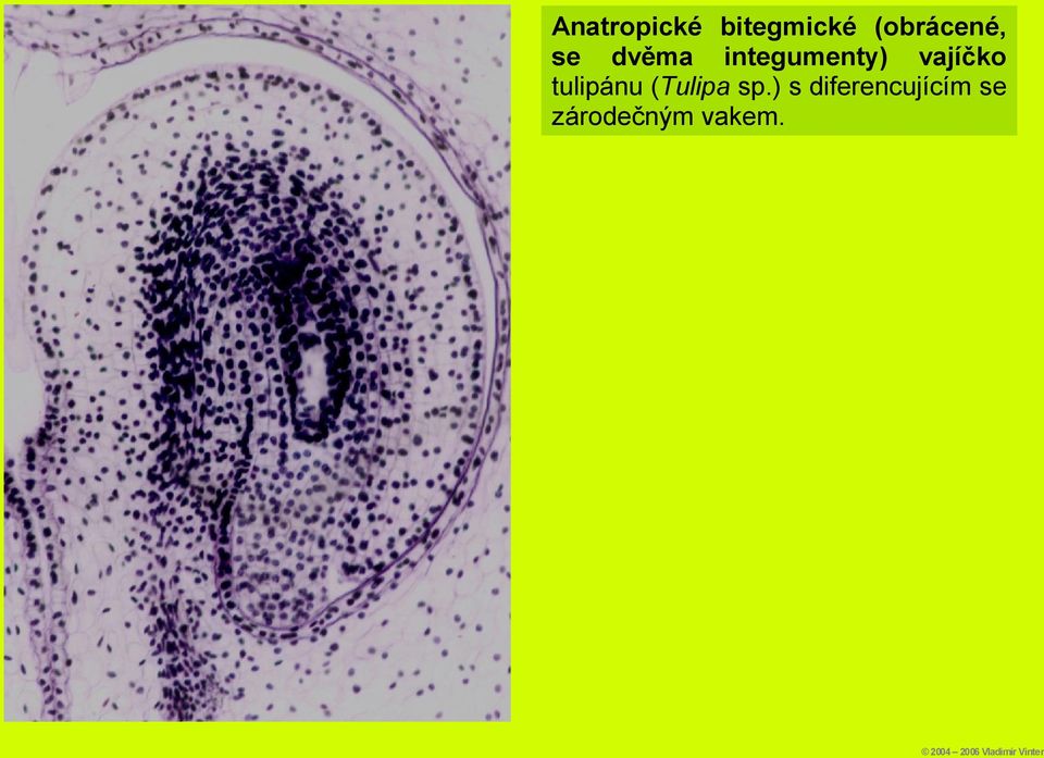 integumenty) vajíčko tulipánu