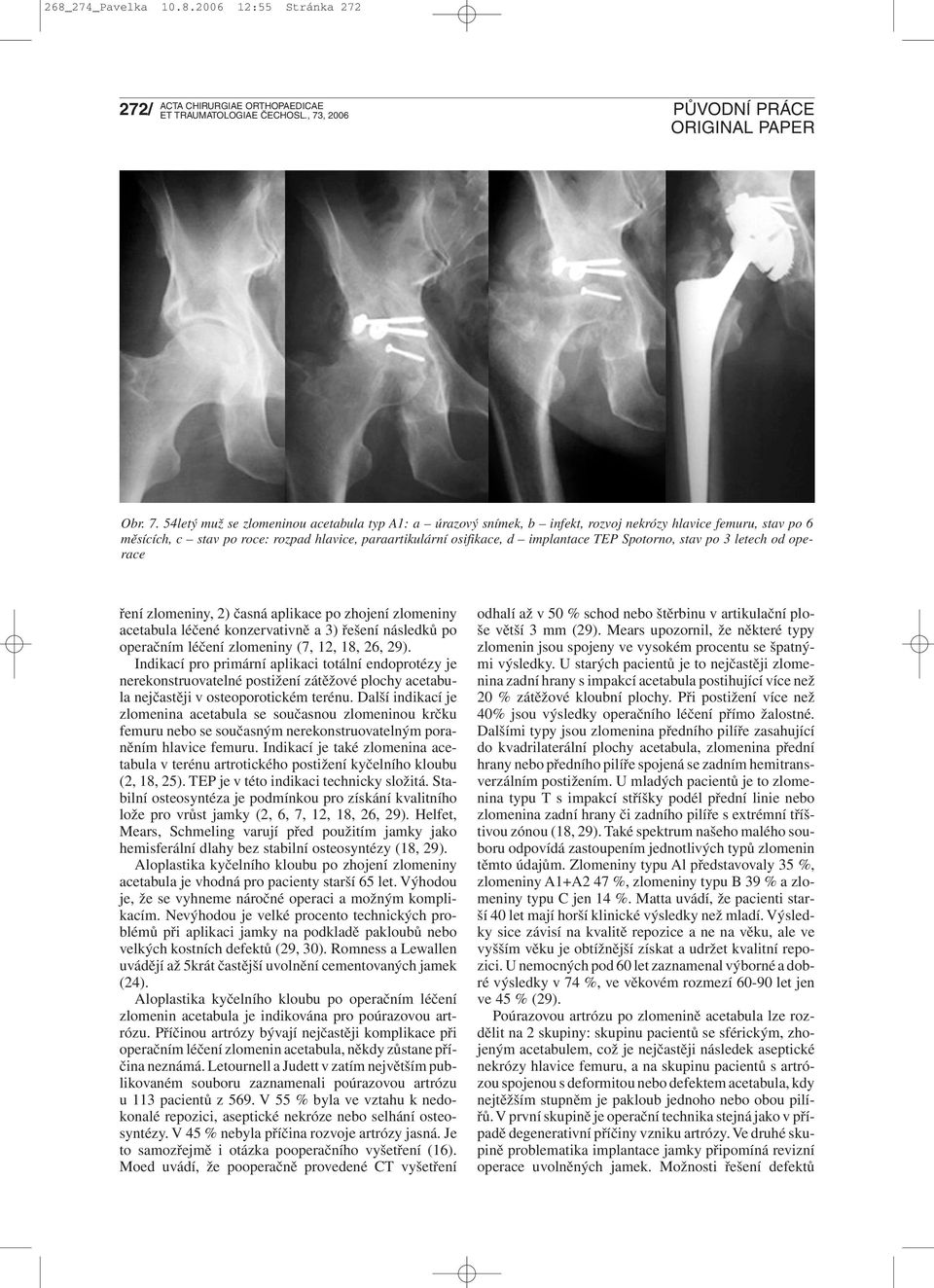 Spotorno, stav po 3 letech od operace ření zlomeniny, 2) časná aplikace po zhojení zlomeniny acetabula léčené konzervativně a 3) řešení následků po operačním léčení zlomeniny (7, 12, 18, 26, 29).