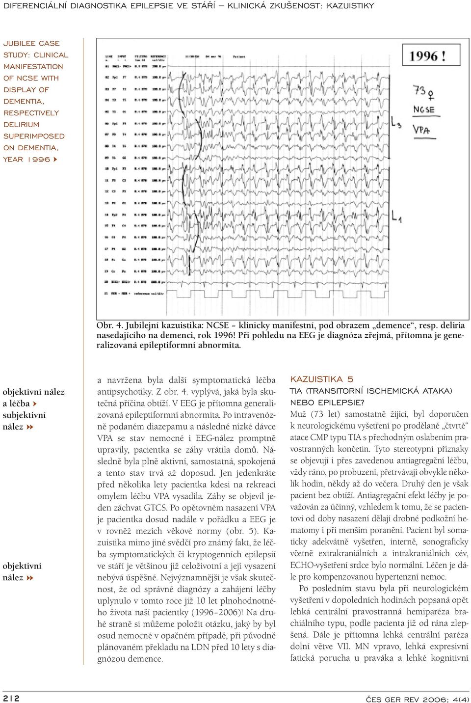 Při pohledu na EEG je diagnóza zřejmá, přítomna je generalizovaná epileptiformní abnormita. objektivní a léčba subjektivní objektivní a navržena byla další symptomatická léčba antipsychotiky. Z obr.