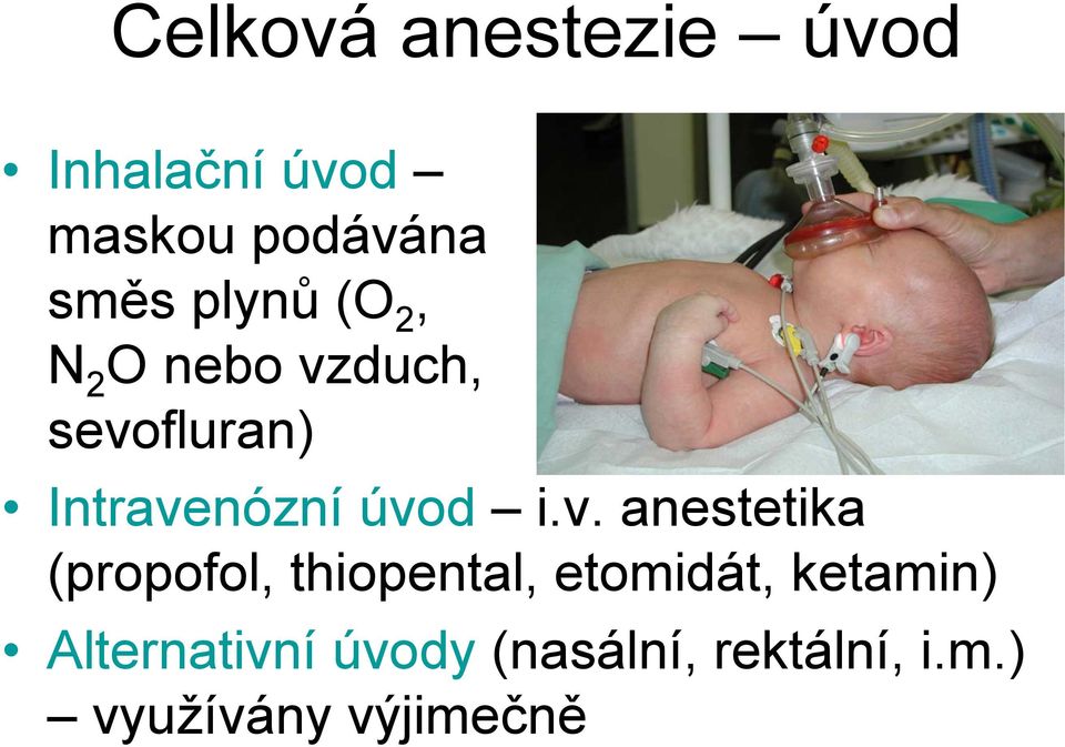 i.v. anestetika (propofol, thiopental, etomidát, ketamin)