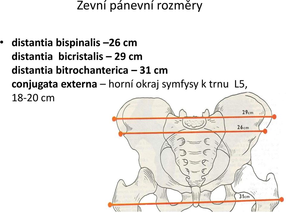 cm distantia bitrochanterica 31 cm