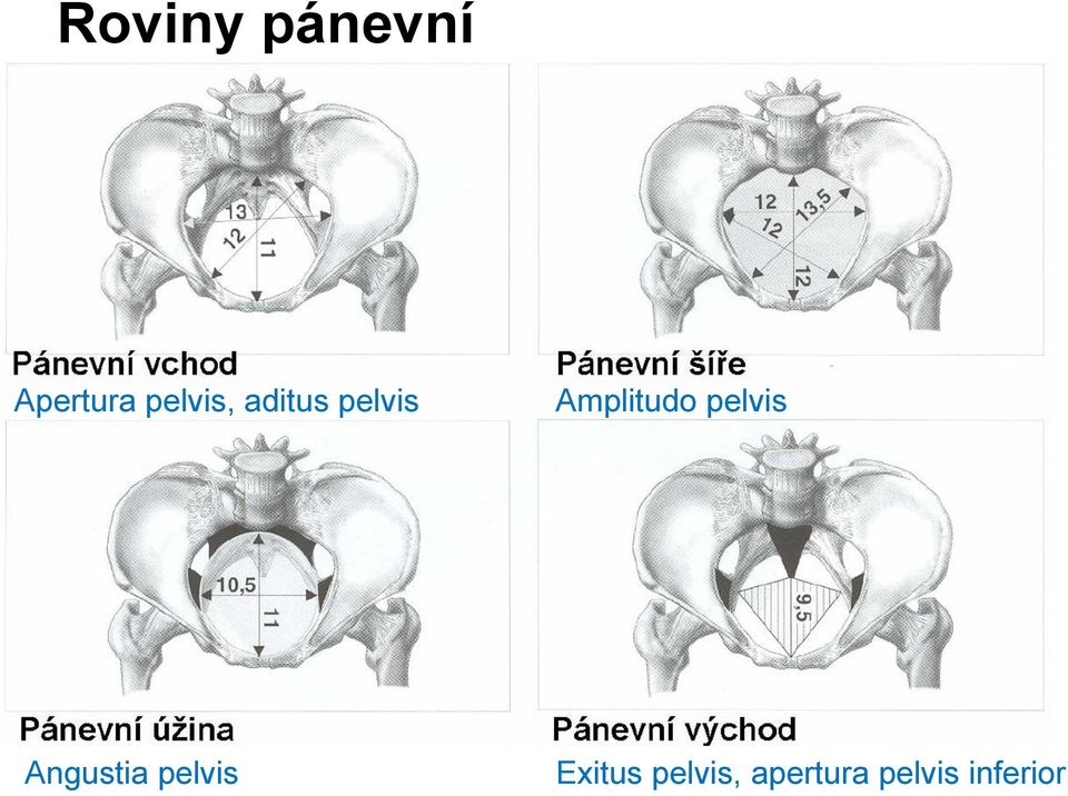 Amplitudo pelvis Angustia