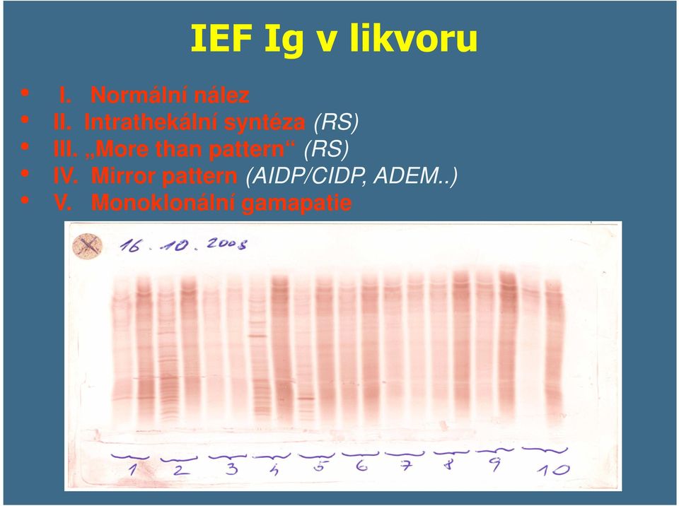 More than pattern (RS) IV.