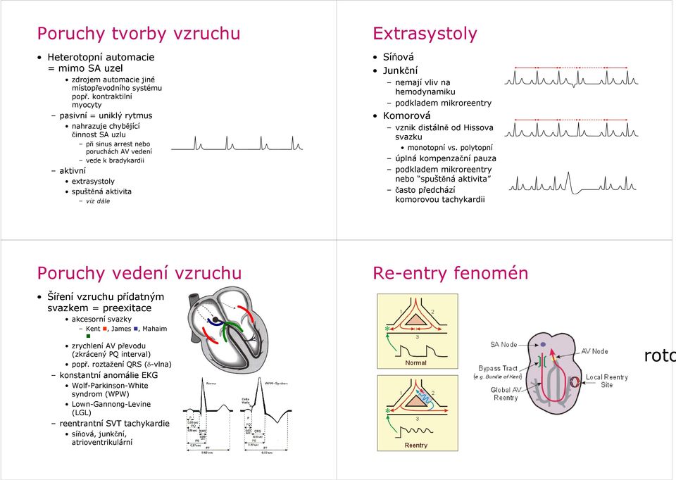 Extrasystoly Síňová Junkční nemají vliv na hemodynamiku podkladem mikroreentry Komorová vznik distálně od Hissova svazku monotopní vs.