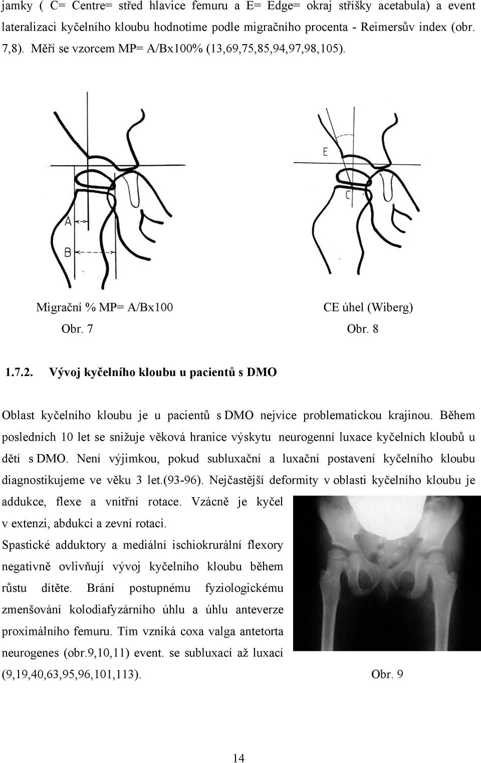 Vývoj kyčelního kloubu u pacientů s DMO Oblast kyčelního kloubu je u pacientů s DMO nejvíce problematickou krajinou.