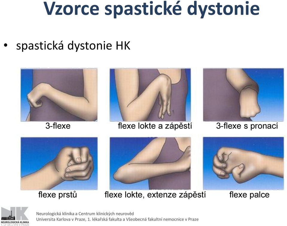 zápěstí 3-flexe s pronací flexe