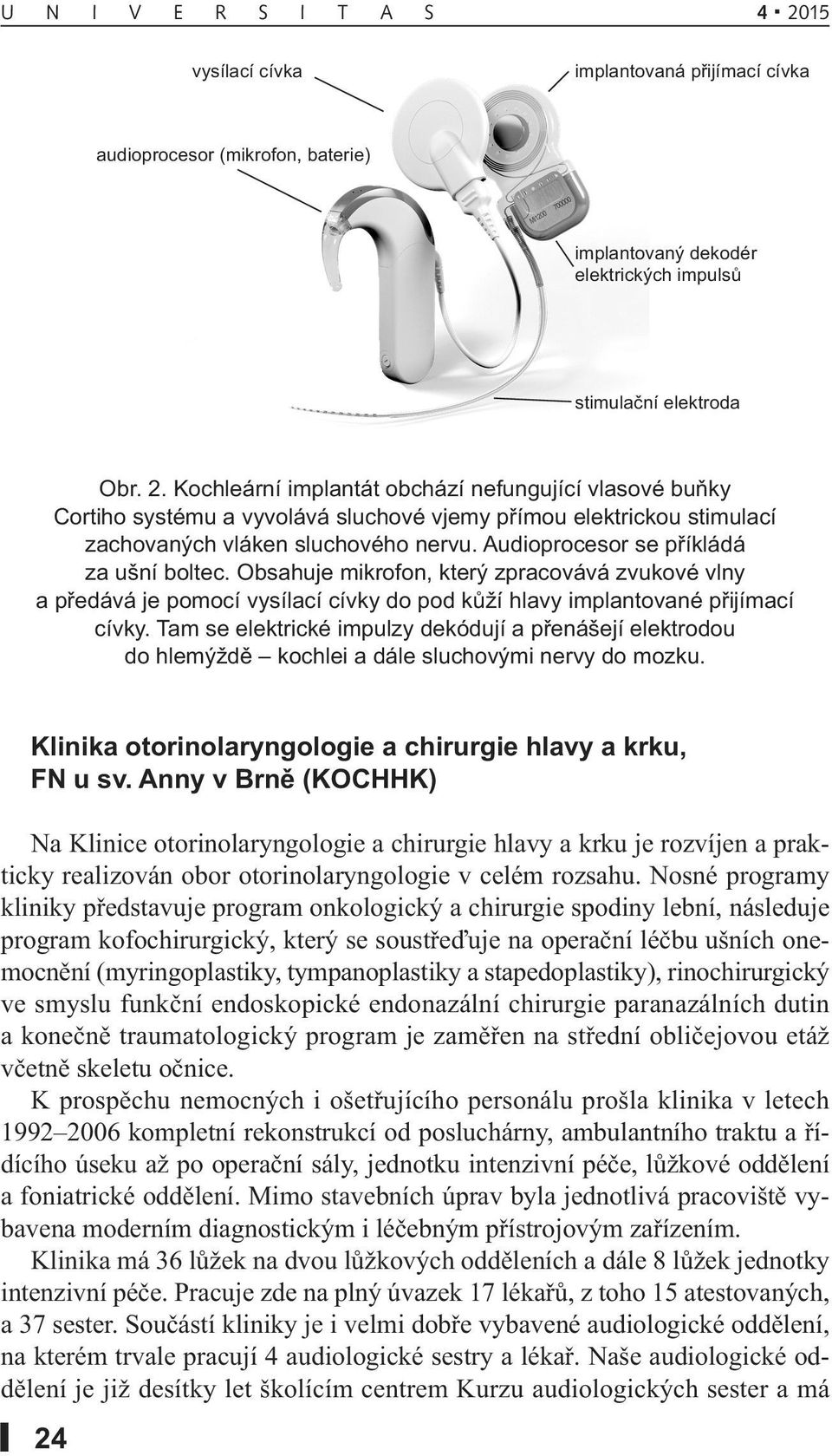 Audioprocesor se příkládá za ušní boltec. Obsahuje mikrofon, který zpracovává zvukové vlny a předává je pomocí vysílací cívky do pod kůží hlavy implantované přijímací cívky.