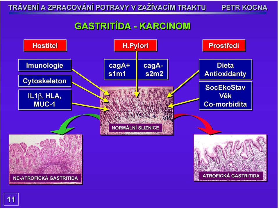 MUC-1 caga+ + caga- s1m1 s2m2 Dieta Antioxidanty