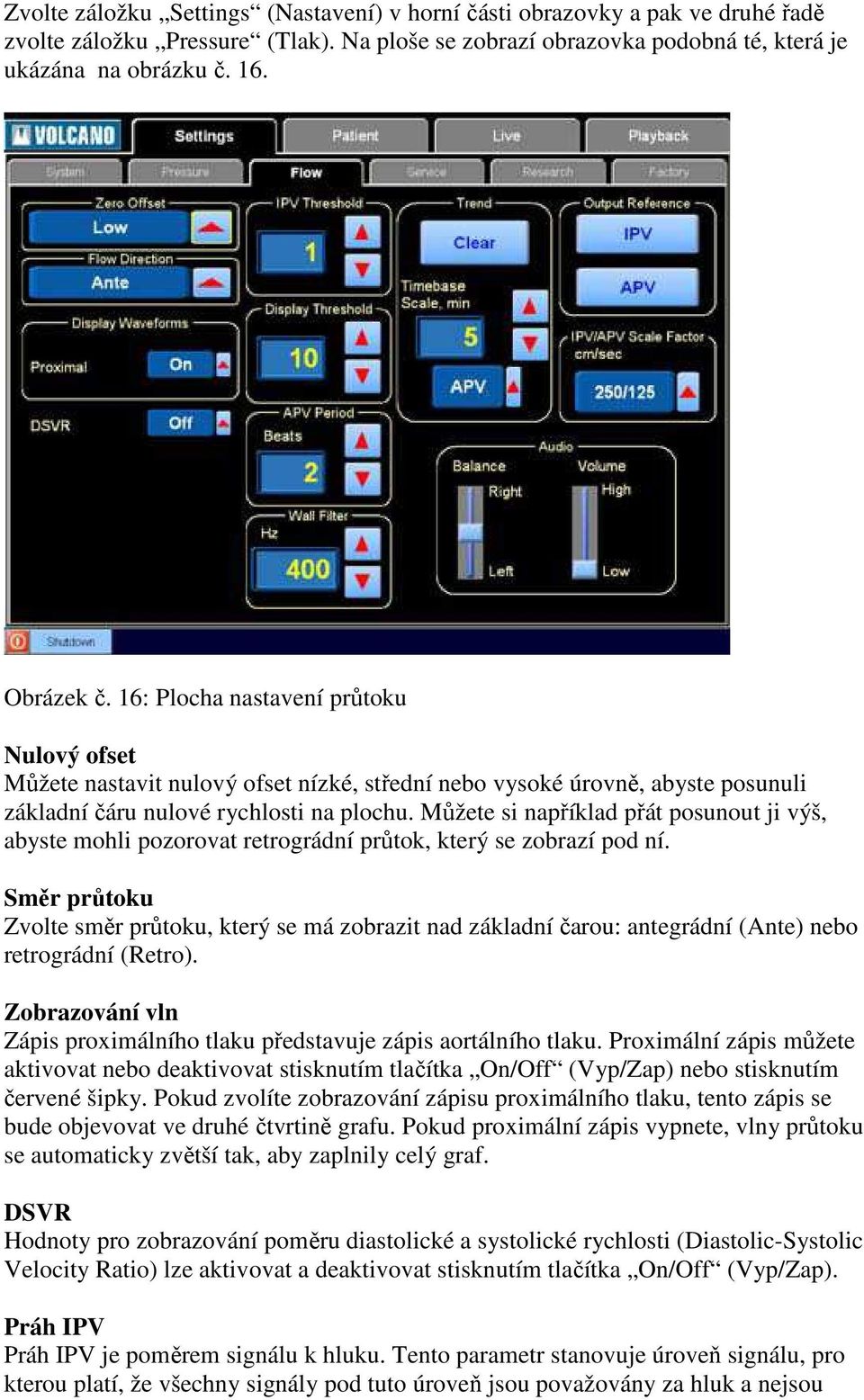 Můžete si například přát posunout ji výš, abyste mohli pozorovat retrográdní průtok, který se zobrazí pod ní.